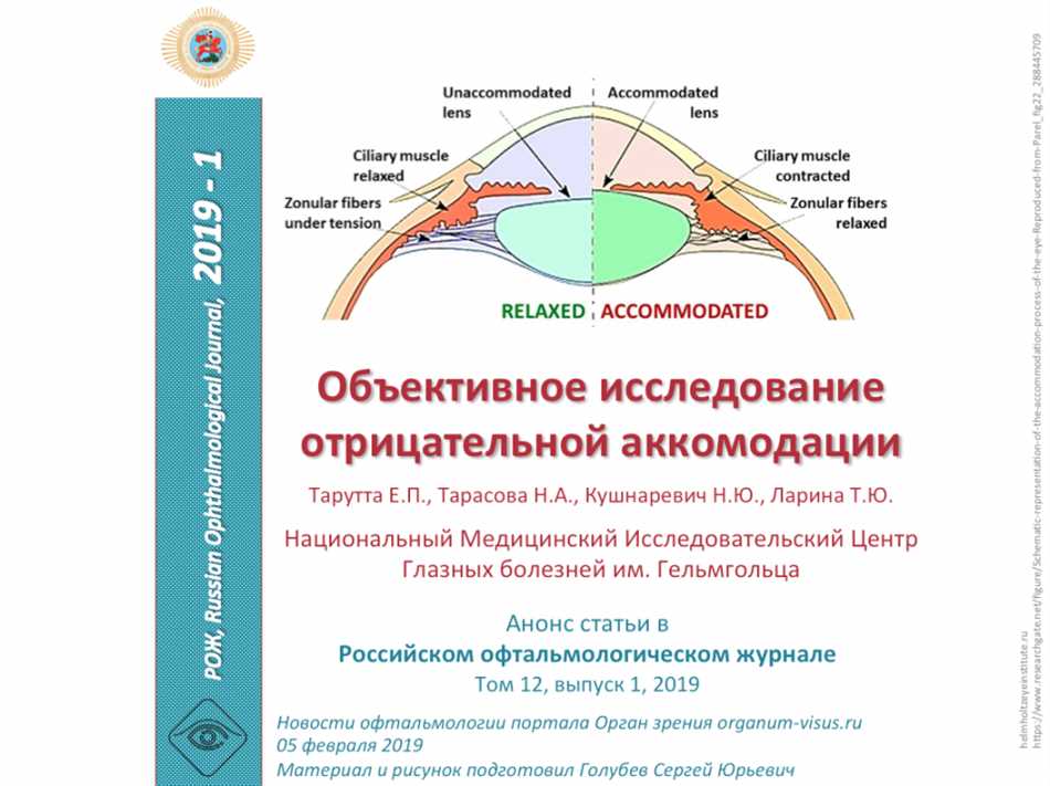 Аккомодация: простыми словами об офтальмологическом понятии