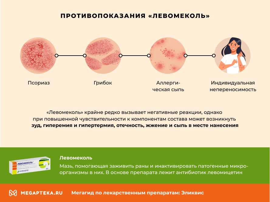 Аллергия на Левомеколь мазь: что делать?