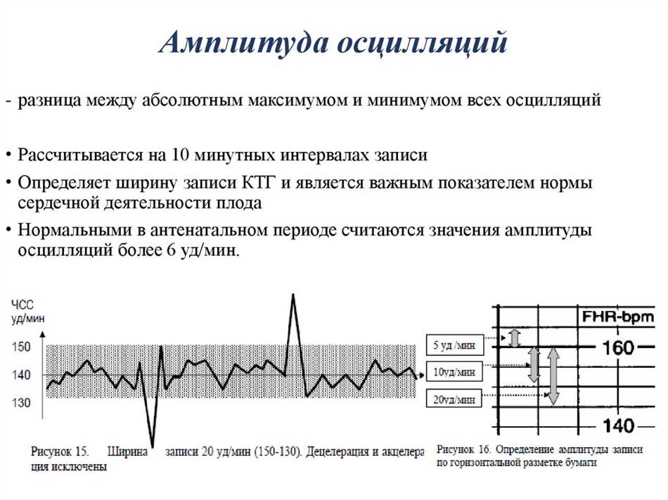 Значимость амплитуды осцилляций КТГ