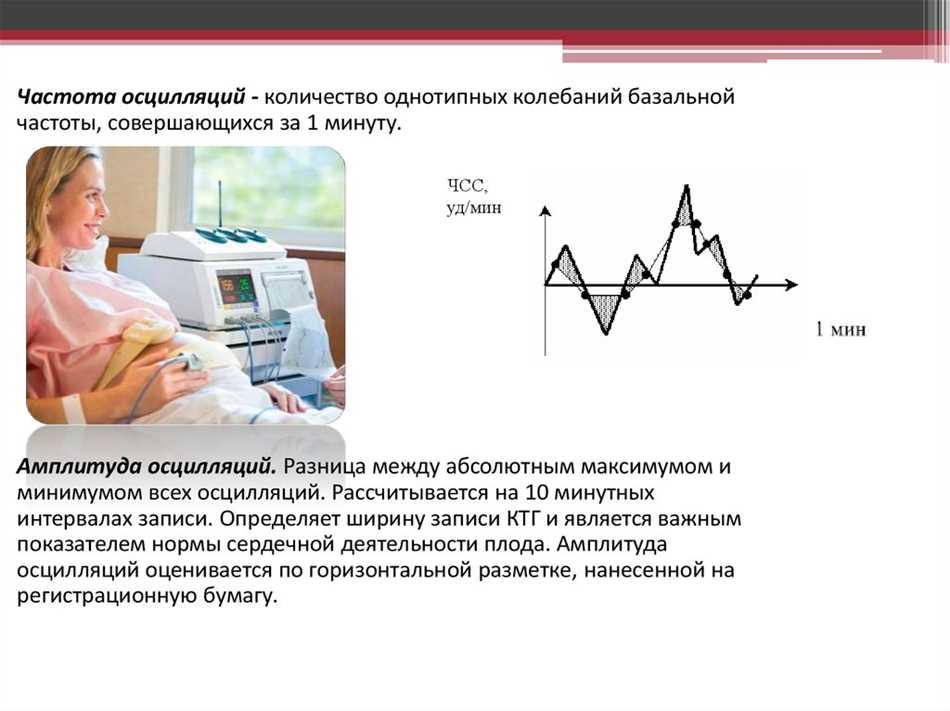 Определение амплитуды КТГ