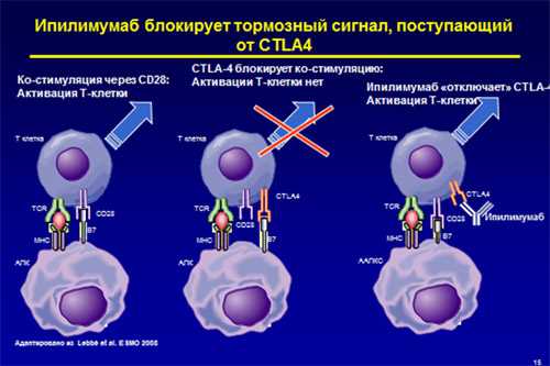 Определение и понятие ангиолимфатической инвазии