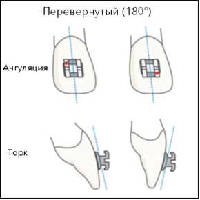 Применение ангуляции в трейдинге