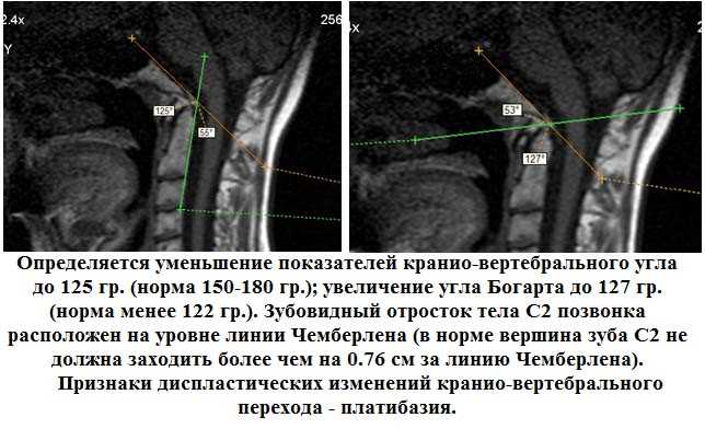 Диагностика и лечение АКВП