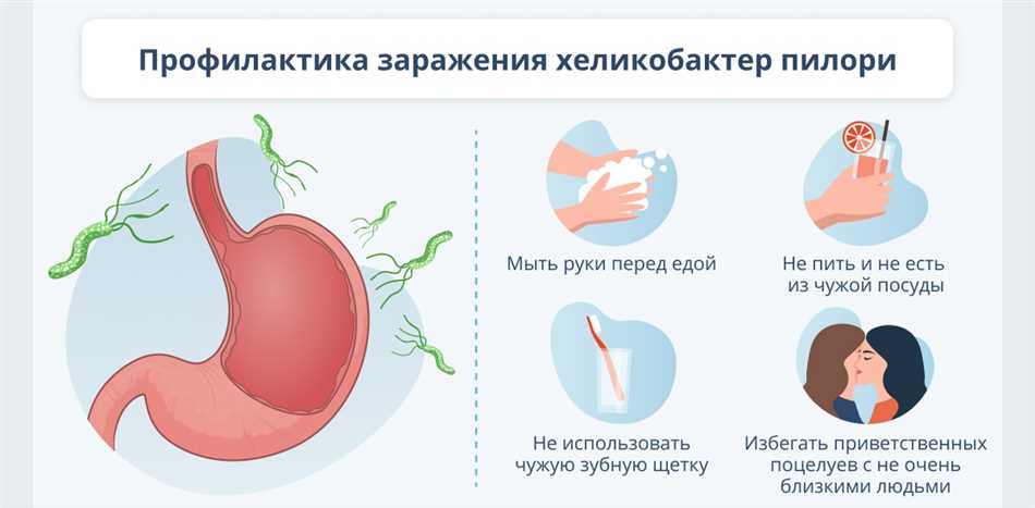 Анти хеликобактер пилори IgM положительный: что это?