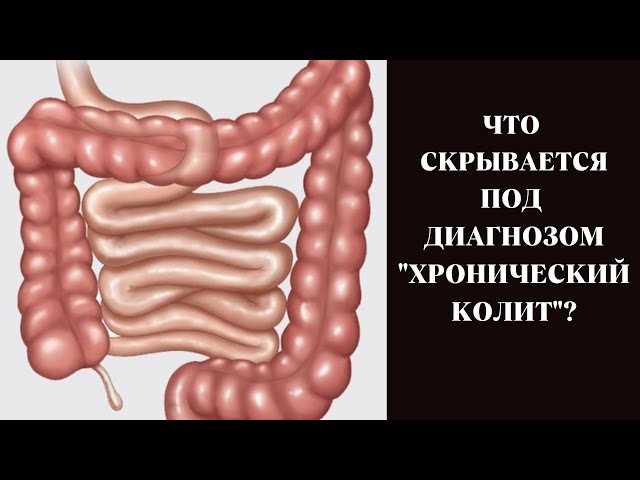 Симптомы атрофического колита