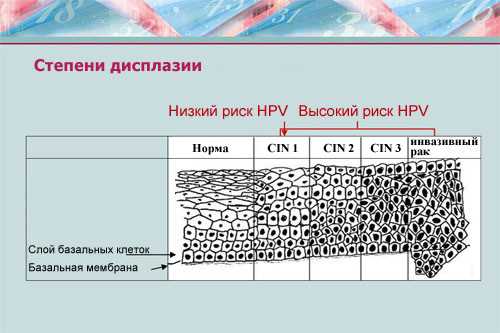 2. Уточнение диагноза