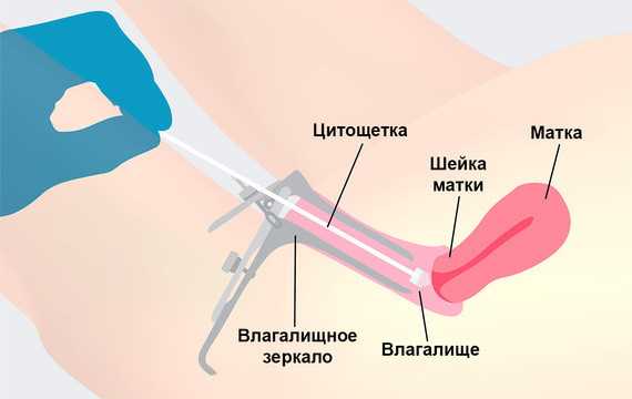 Как проходит баканализ?