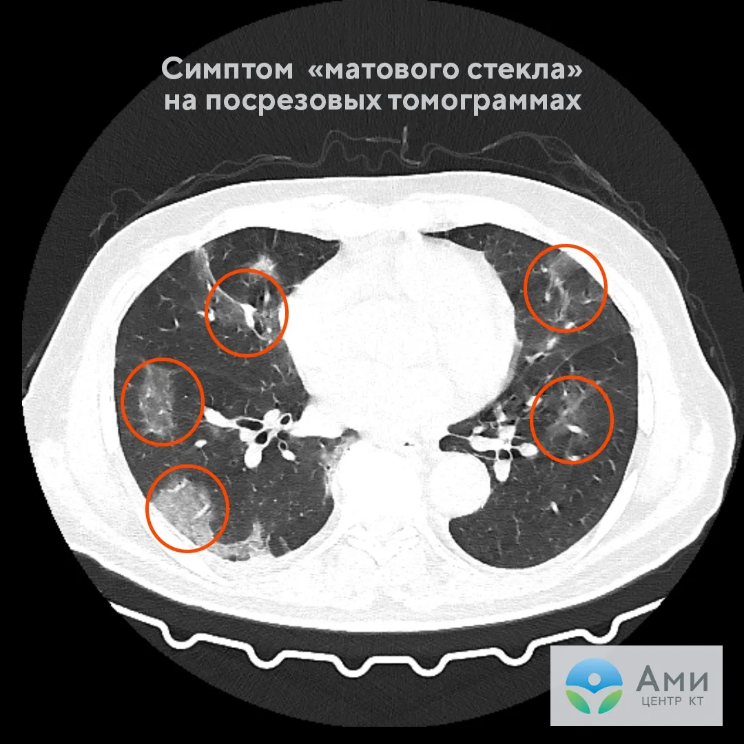 5. Повышение иммунитета