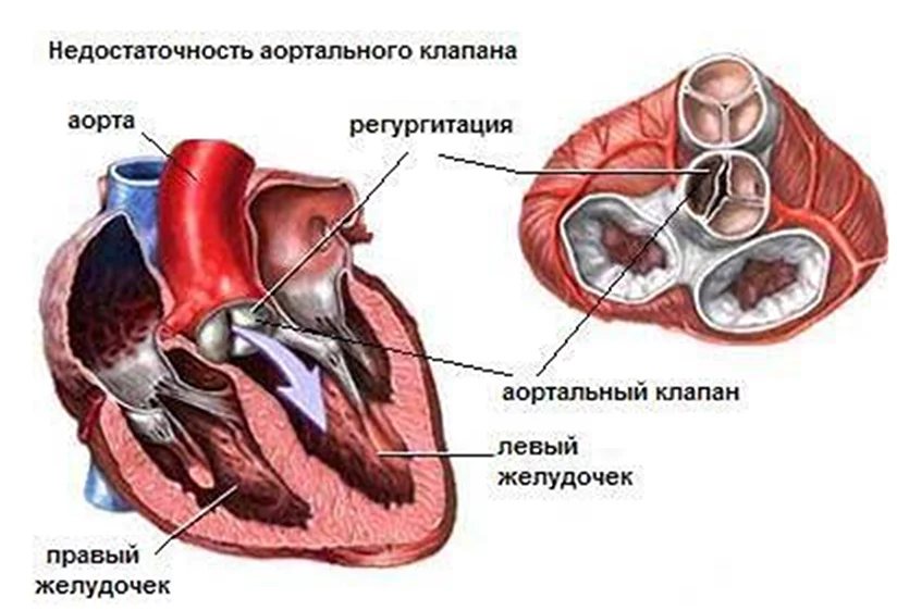 Заключение