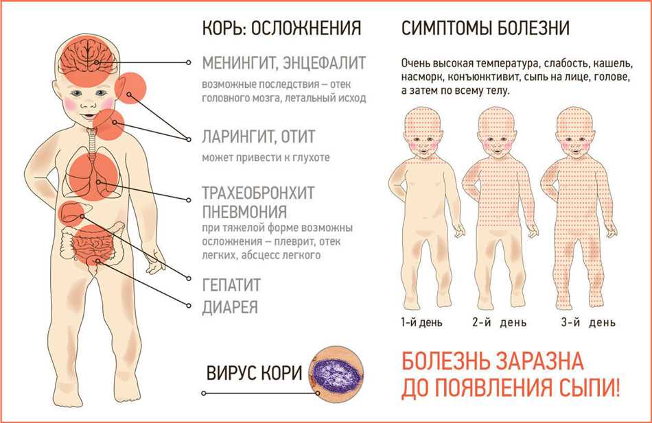 Что такое ККП прививка?