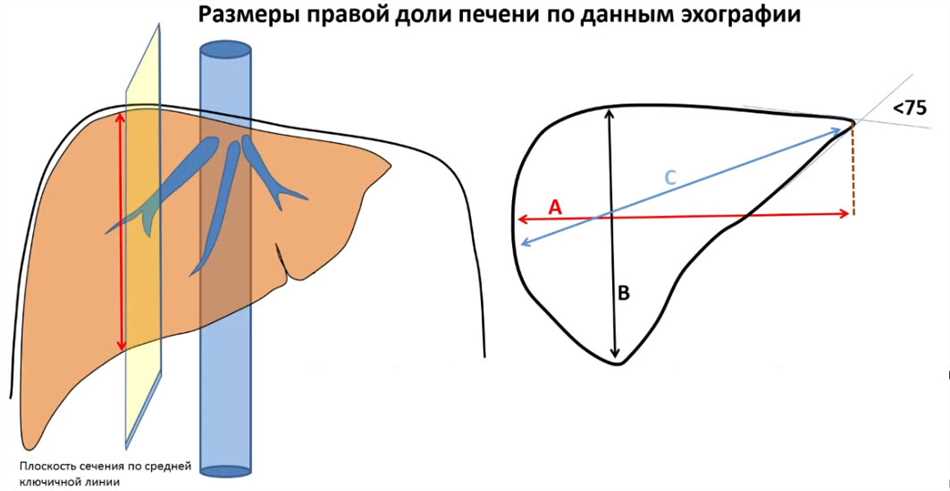 Что такое КВР печени?