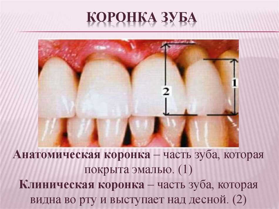 Зачем необходима клиническая коронка зуба?