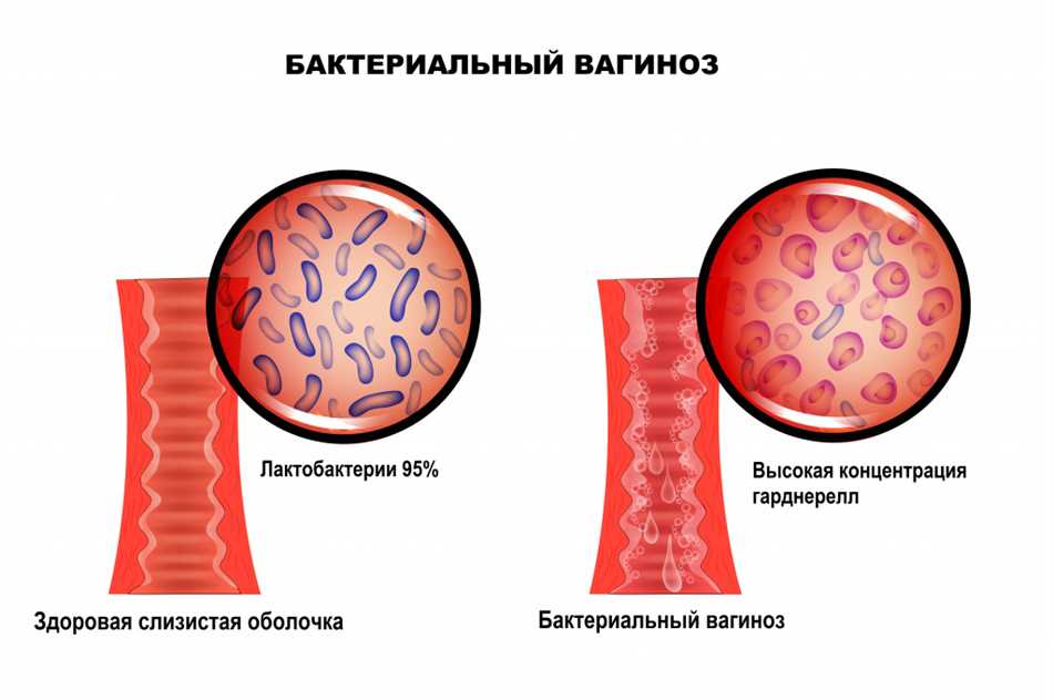 Что такое ключевые клетки