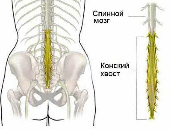 Что такое конский хвост спинного мозга?