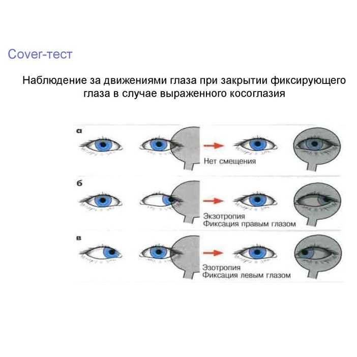 Значение конвергенции глаза для зрения человека