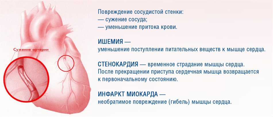 Диагностика коронарной недостаточности сердца