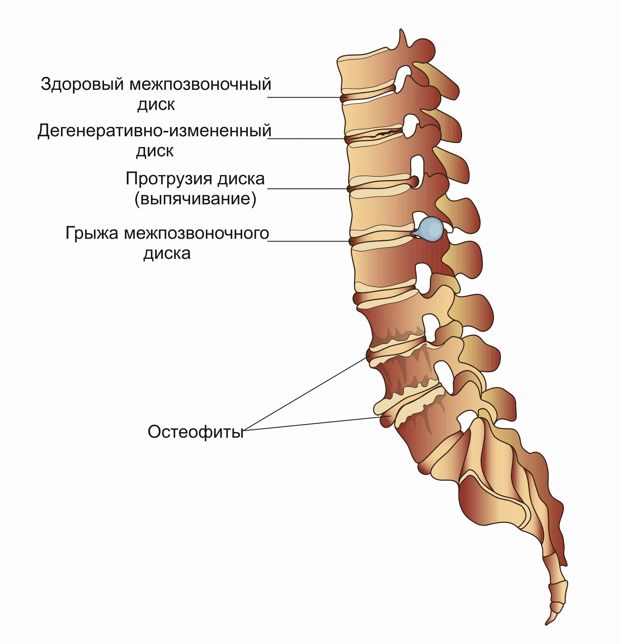 Определение