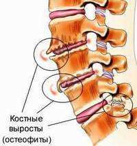 Лечение и профилактика