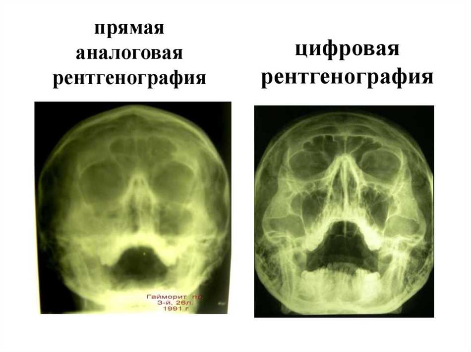 Применение рентгеноскопии