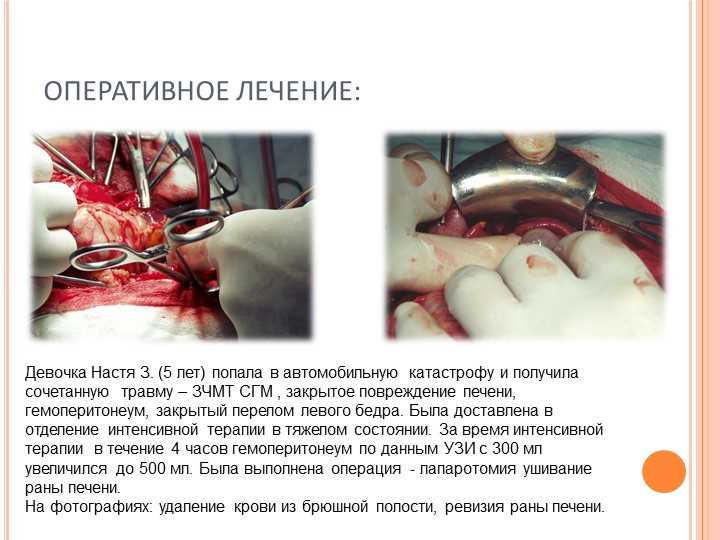 Ревизия брюшной полости: что это такое?