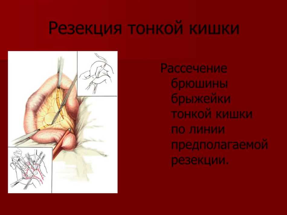 Послеоперационный период и реабилитация