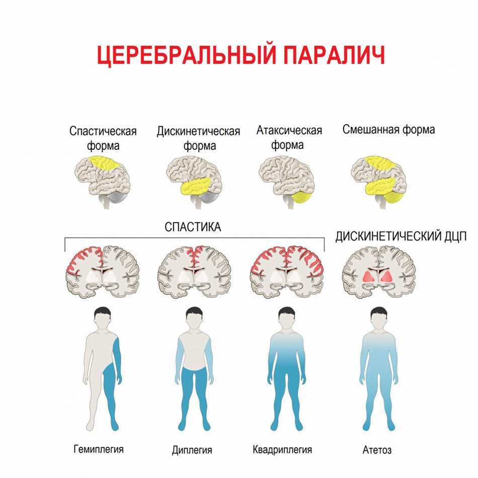 Как помочь ребенку с резидуальным фоном?