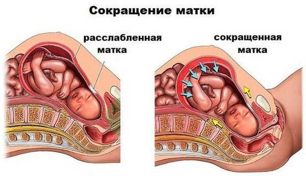 Родовая доминанта: основное понятие