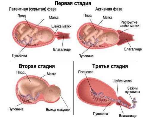 Главные черты родовой пробки