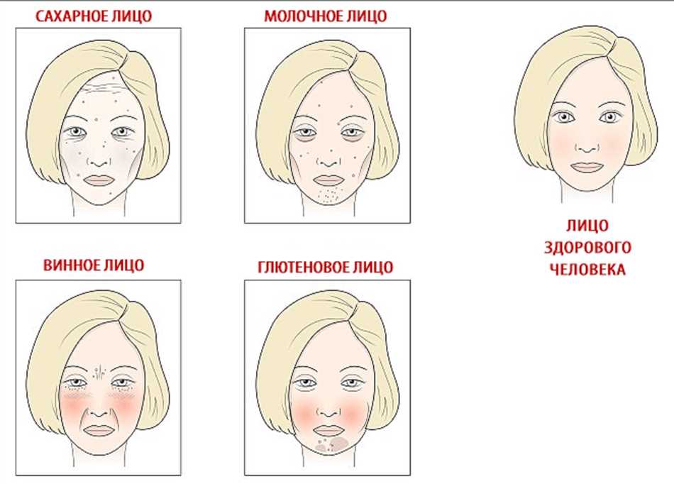 Влияние сахарного лица на состояние кожи
