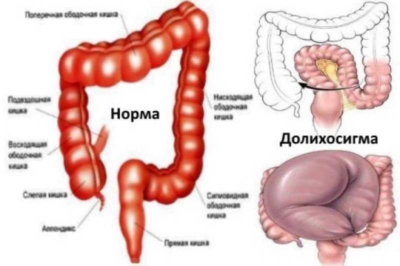 Заключение: