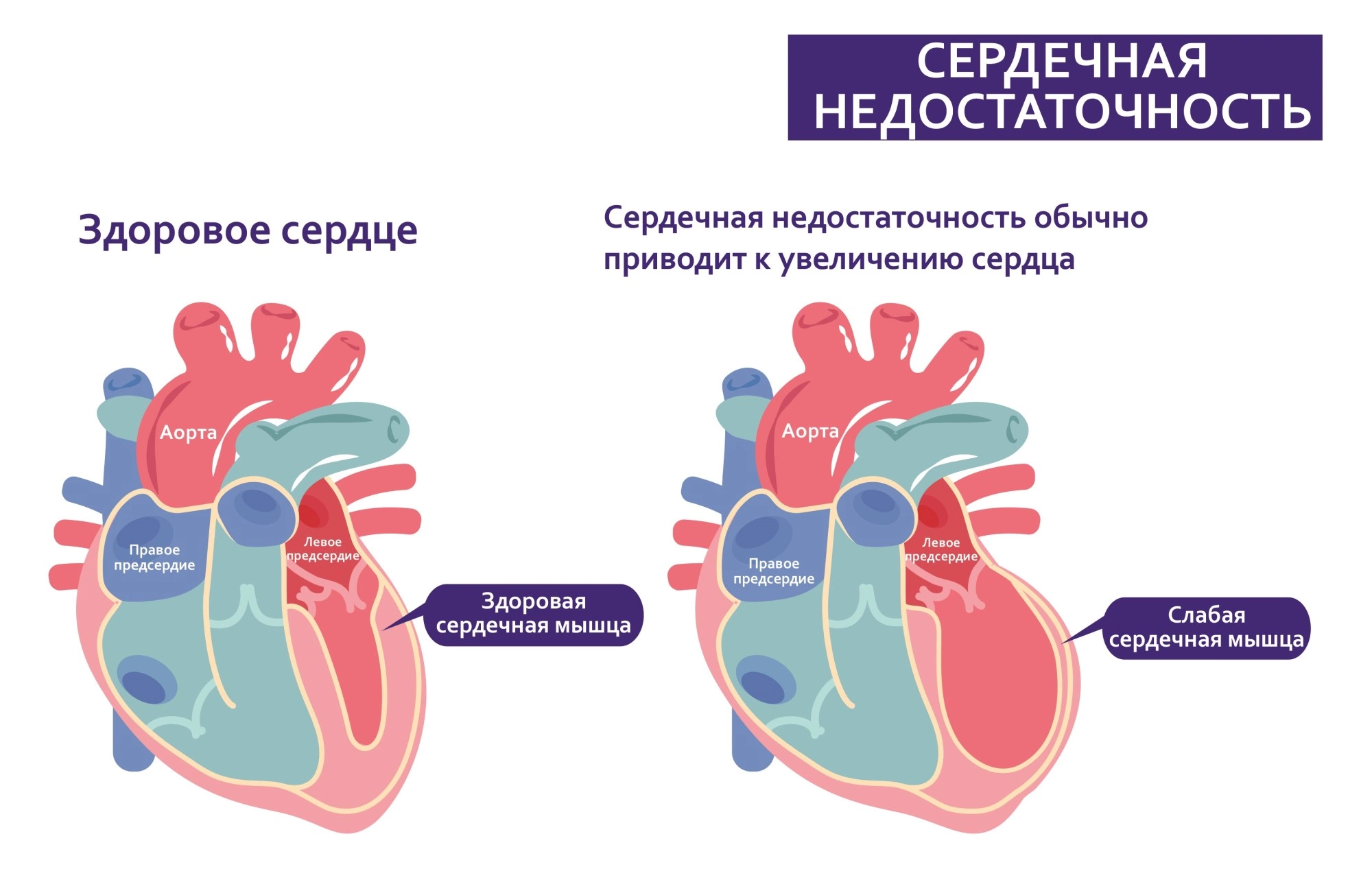 2. Активный образ жизни