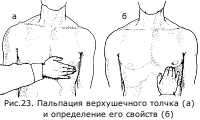 Заболевания, связанные с сердечным толчком