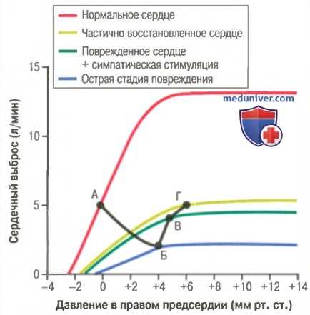 Виды сердечных выбросов