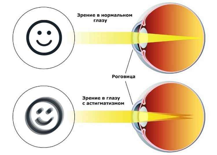 Что такое сигматика зрения?