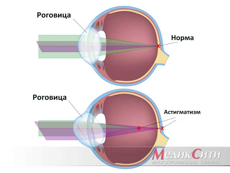 Что такое сигматика зрения: принципы и особенности