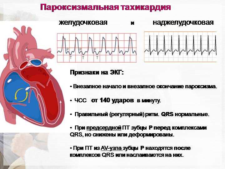 Диагностика синусовой тахиаритмии