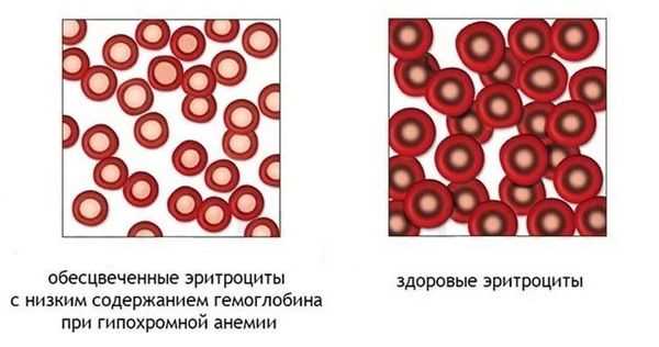 Как лечить скрытую анемию при нормальном гемоглобине?