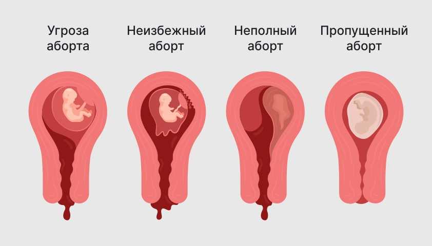 Что такое скрытое кровотечение