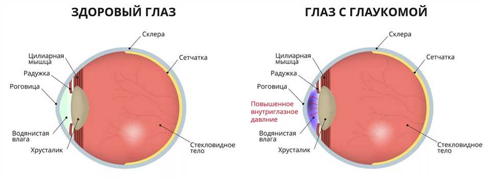 Причины развития слепоты обоих глаз