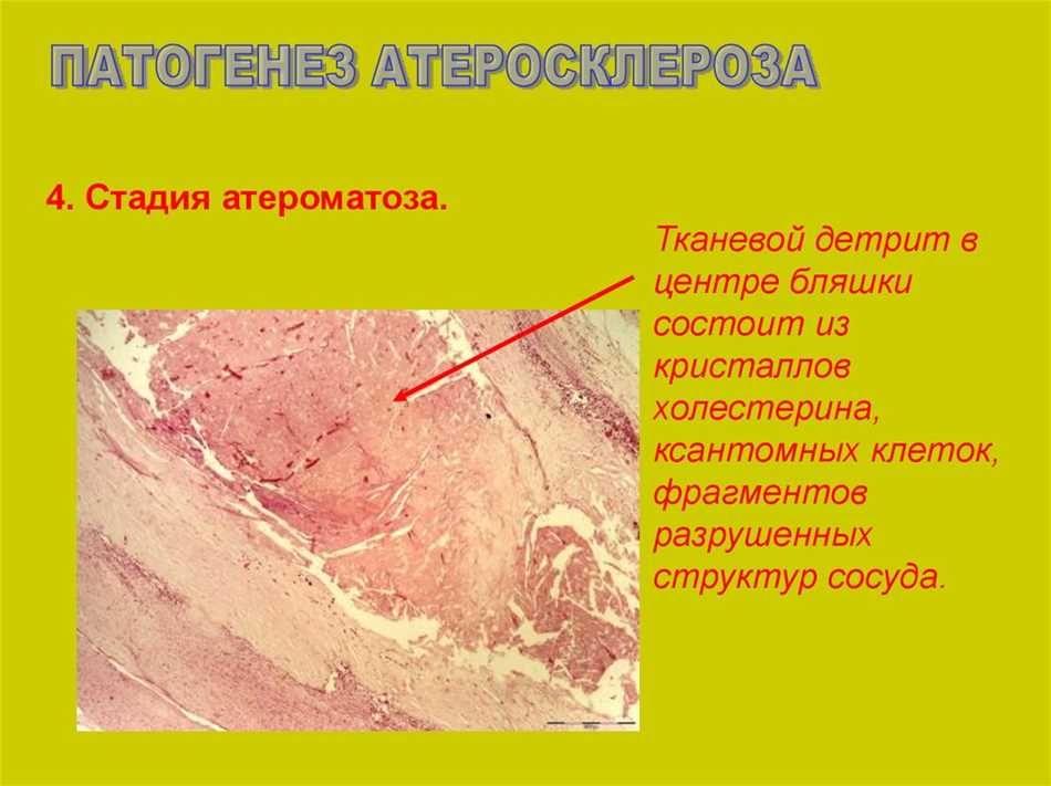 Тканевой детрит: определение и особенности