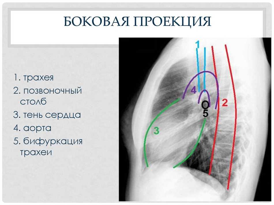 Две проекции флюорографии: что это?