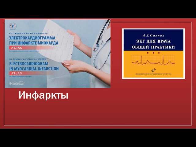 Инфаркт: патанатомия, причины, симптомы и лечение