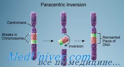 Инверсия в генетике: что это такое и как она проявляется