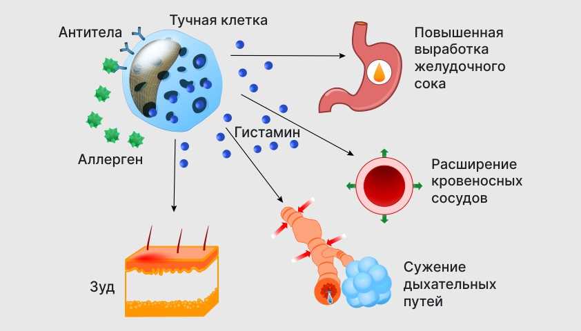 Способы борьбы с аллергией на влажный воздух 