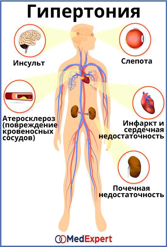 Что делать, если у вас есть одышка?