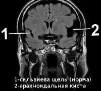 Воспалительные заболевания