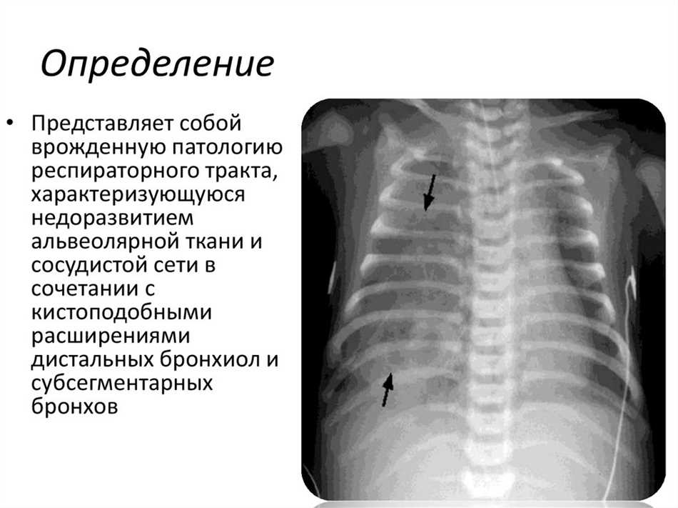 Прогноз