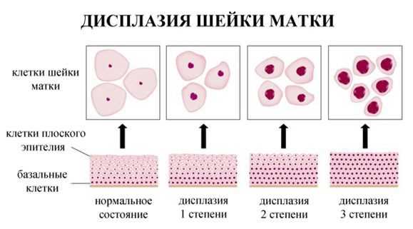 Определение