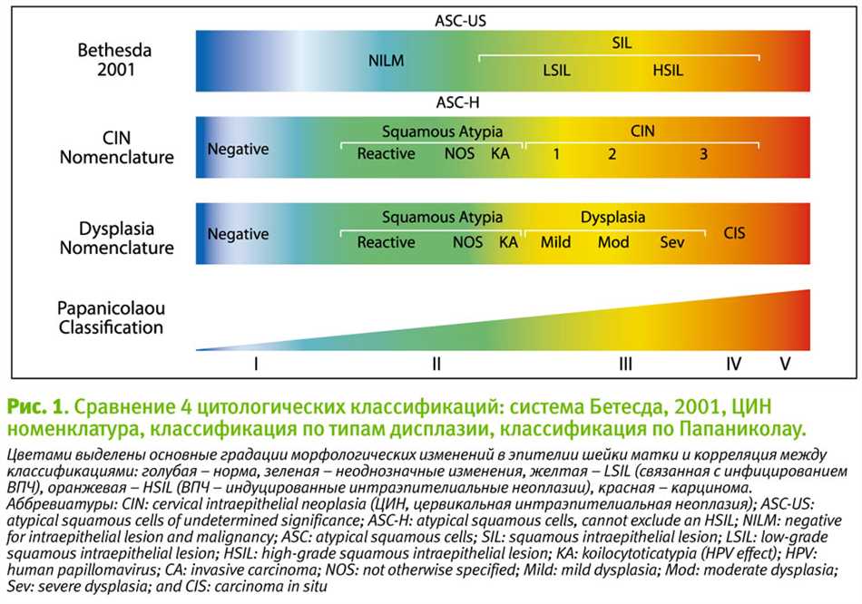 Цитология nilm что означает. Бетезда классификация цитологии шейки матки. Классификация Бетесда шейки матки. Цитологическая классификация Бетесда шейка матки. Классификация дисплазии шейки матки Бетезда.