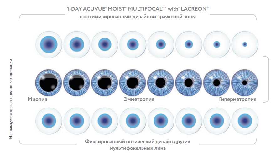 Виды мультифокальных контактных линз